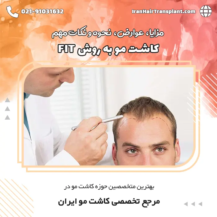 کاشت مو به روش FIT چیست و چطور انجام میشود؟