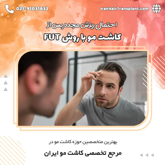 احتمال ریزش مجدد پس از کاشت مو با روش FUT