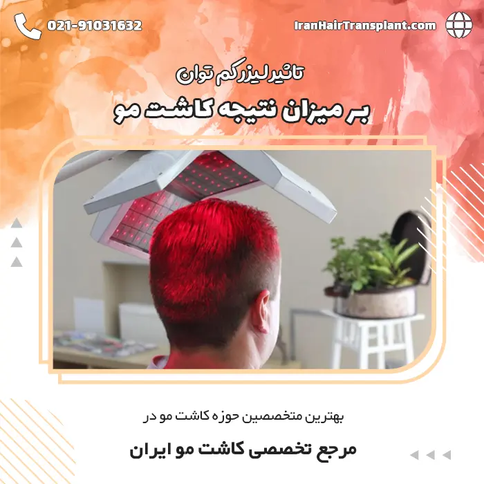 تاثیر لیزر کم توان بر نتیجه کاشت مو