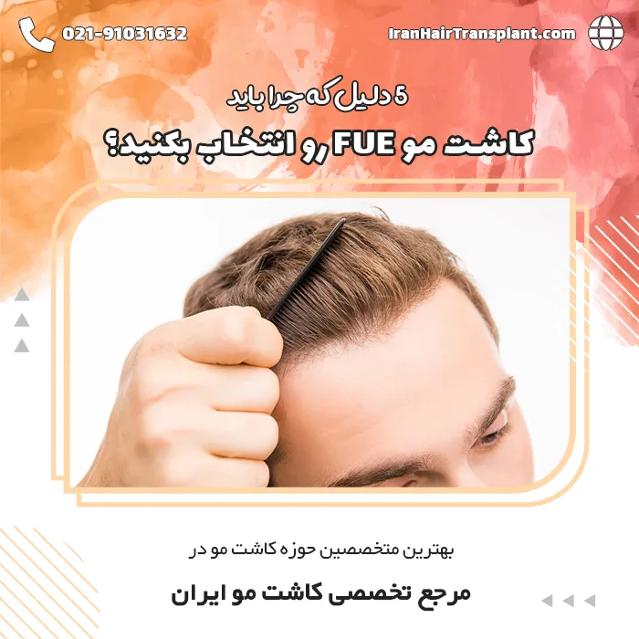 5 دلیل برای انتخاب روش کاشت مو FUE