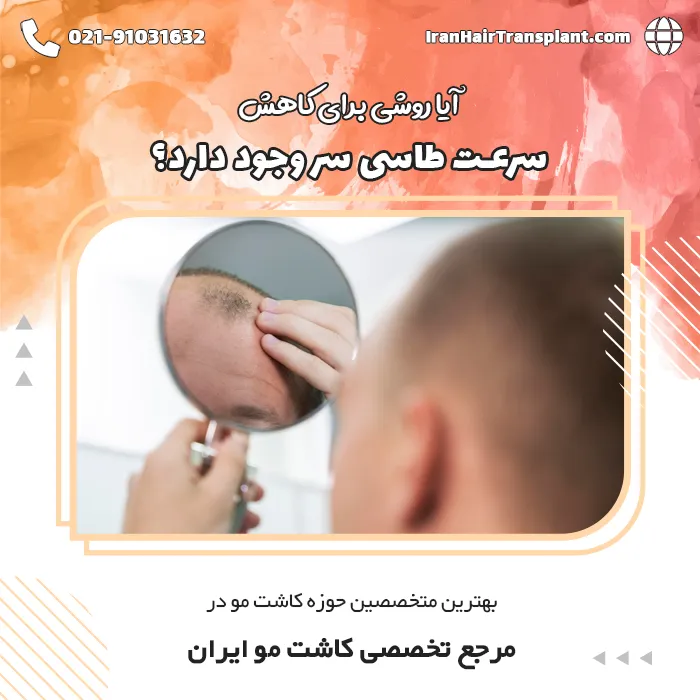 آیا میتوان برای کاهش سرعت طاسی سر کاری کرد؟